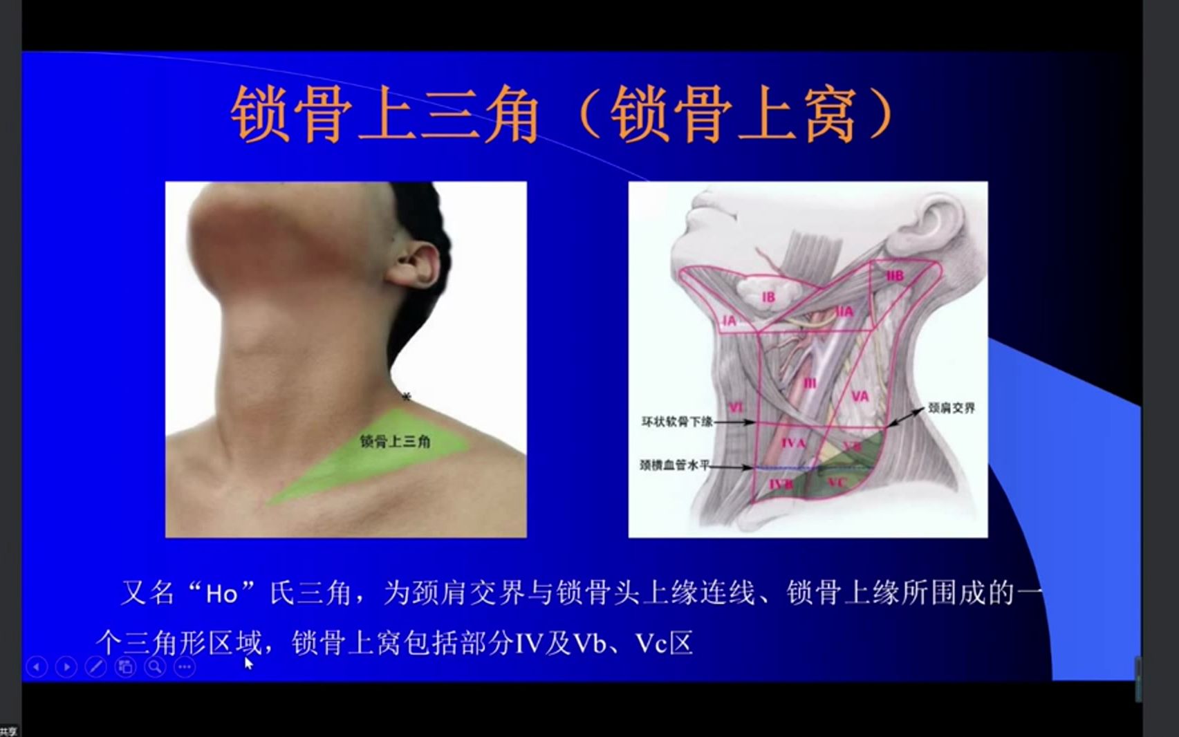 [图]11.基于颈部淋巴结病变的影像学分析思路-头颈影像诊断系列1