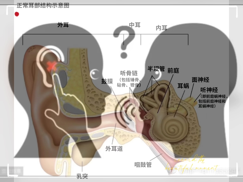 助听器内部结构图图片