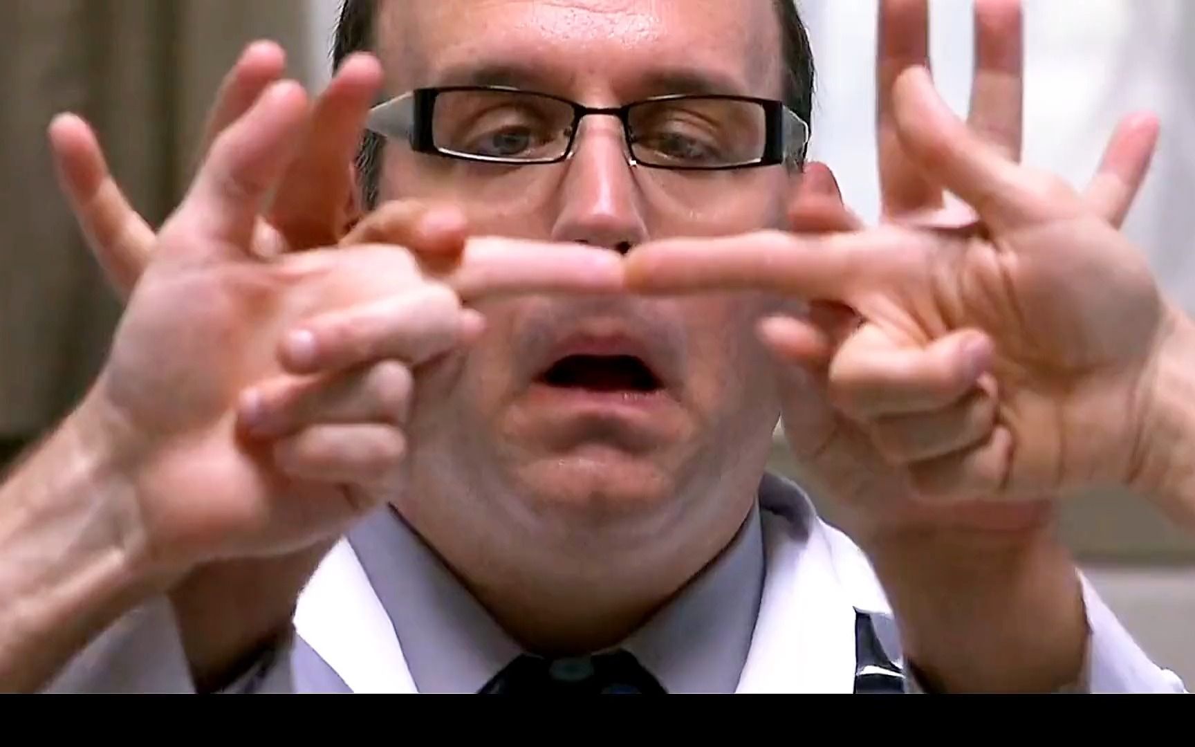 这天假大夫接到一个大活,切割连体兄弟粘连的手指