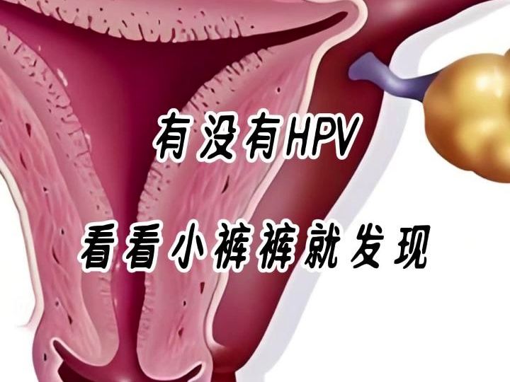 有没有HPV,看看小裤裤就发现哔哩哔哩bilibili