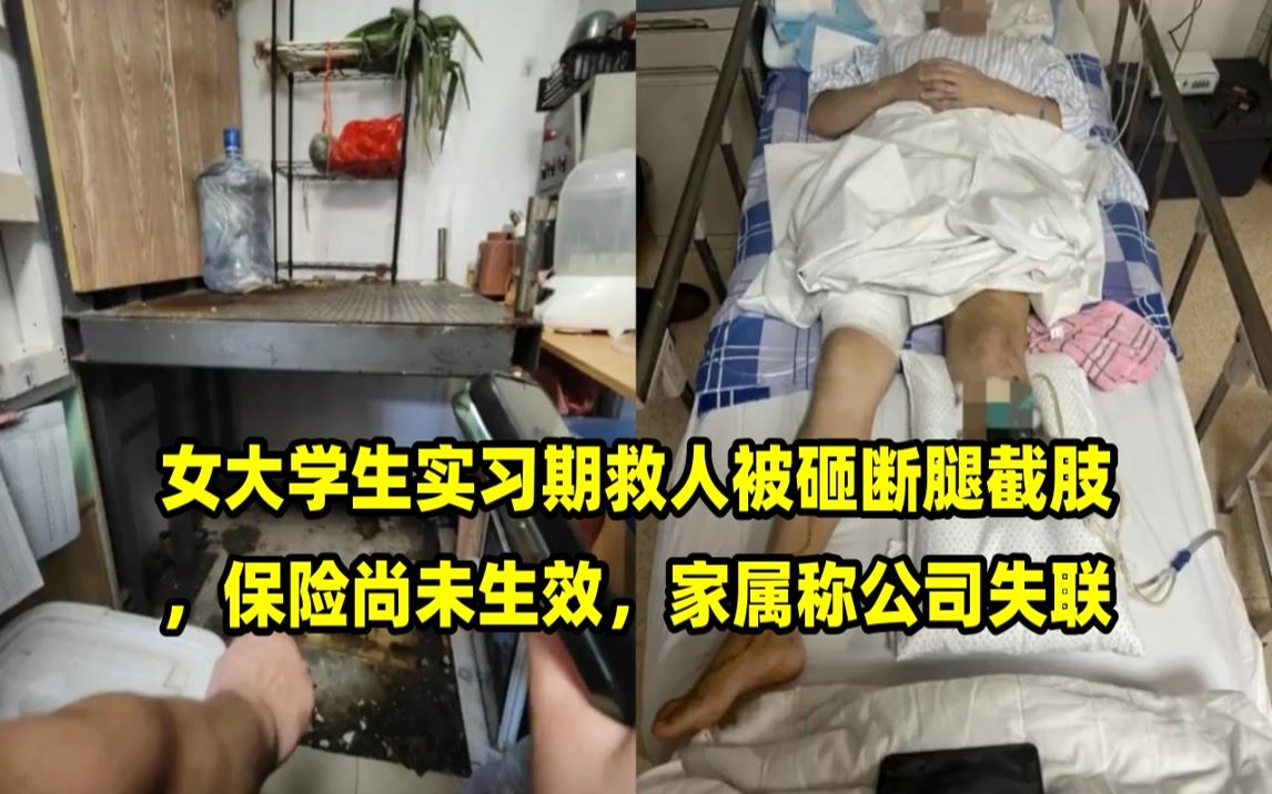 女大学生实习期救人被砸断腿截肢,保险尚未生效,家属称公司失联