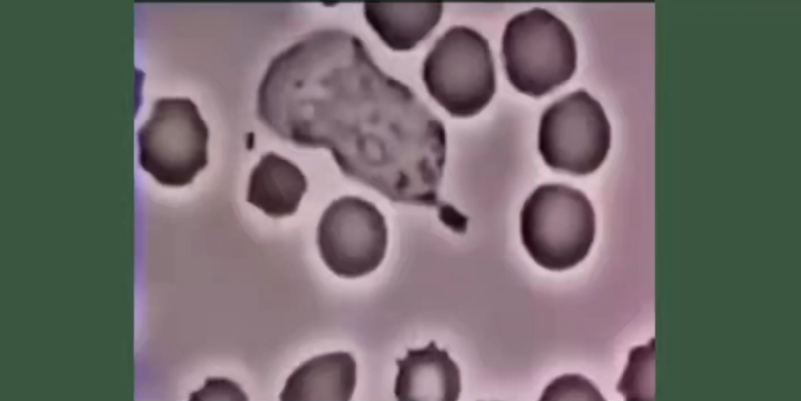 白细胞吃细菌大战图片