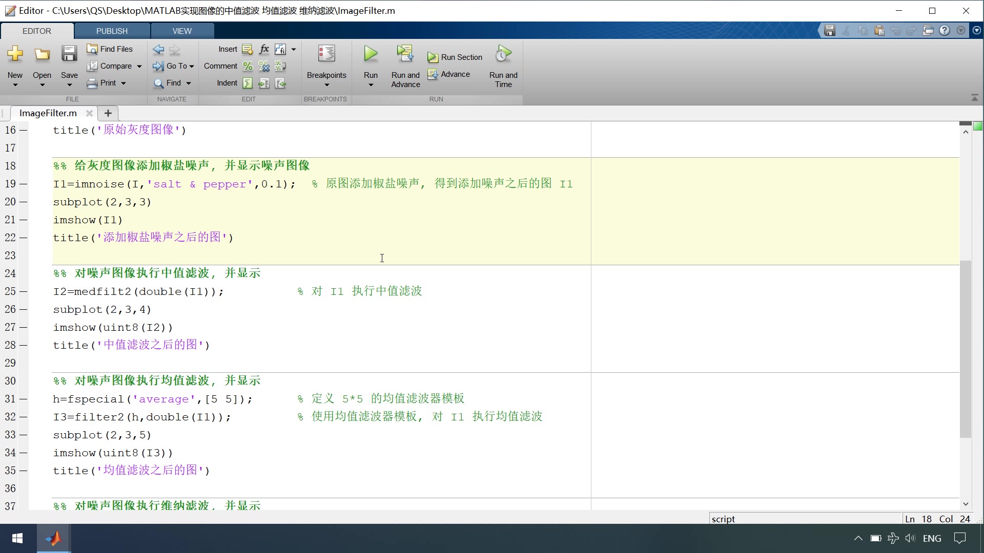 MATLAB代码分享视频:图像的中值滤波 均值滤波 维纳滤波哔哩哔哩bilibili