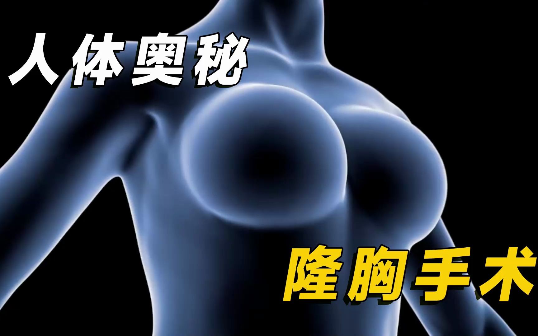 3D动画揭秘隆胸手术的过程哔哩哔哩bilibili