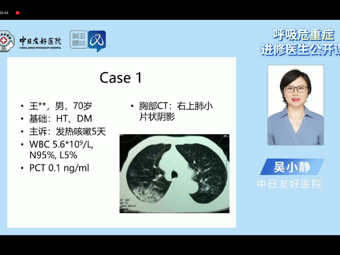 第24课 Sepsis 和 Septic shock哔哩哔哩bilibili