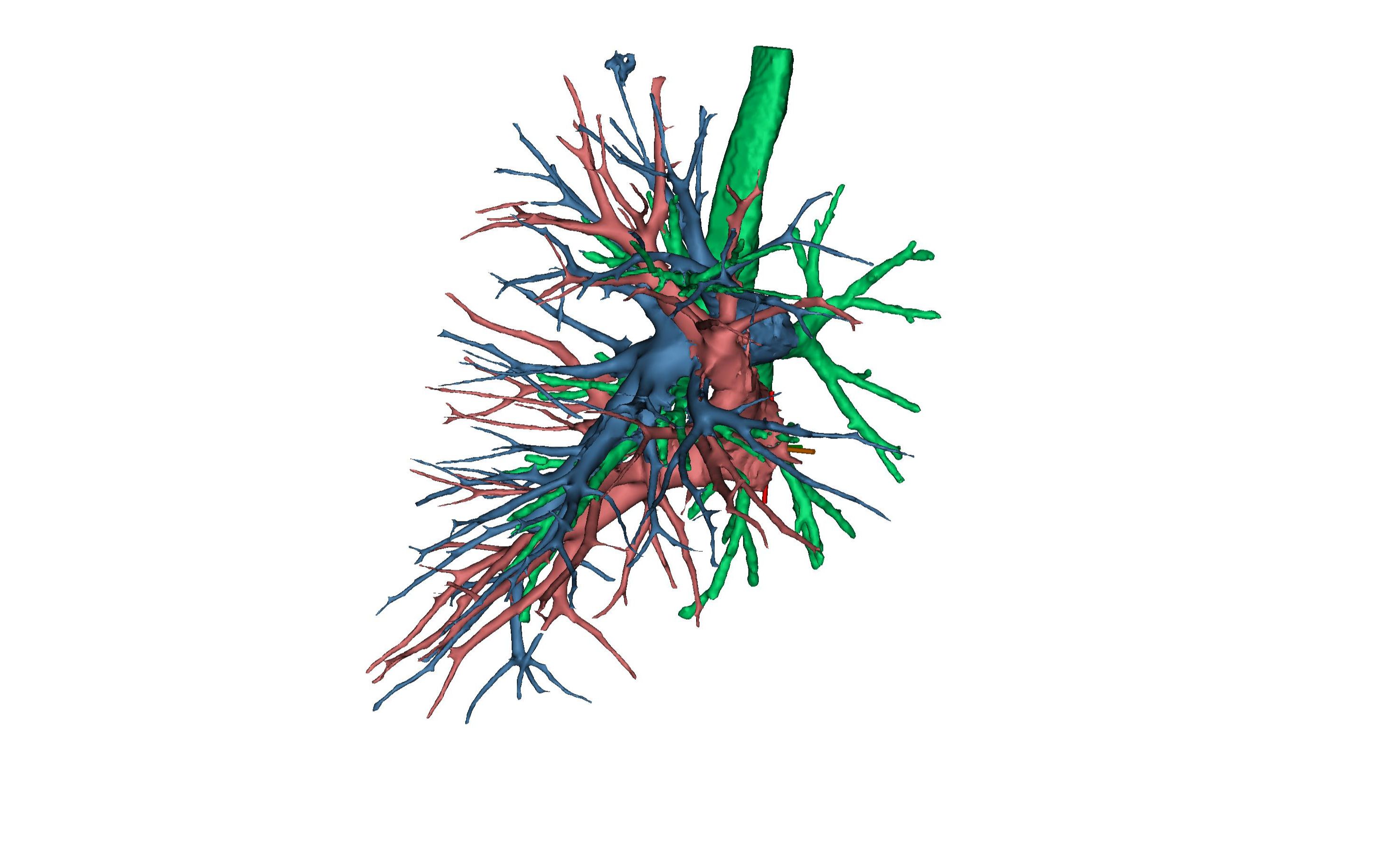 重建肺三维模型-4.肺动静脉重建_哔哩哔哩_bilibili
