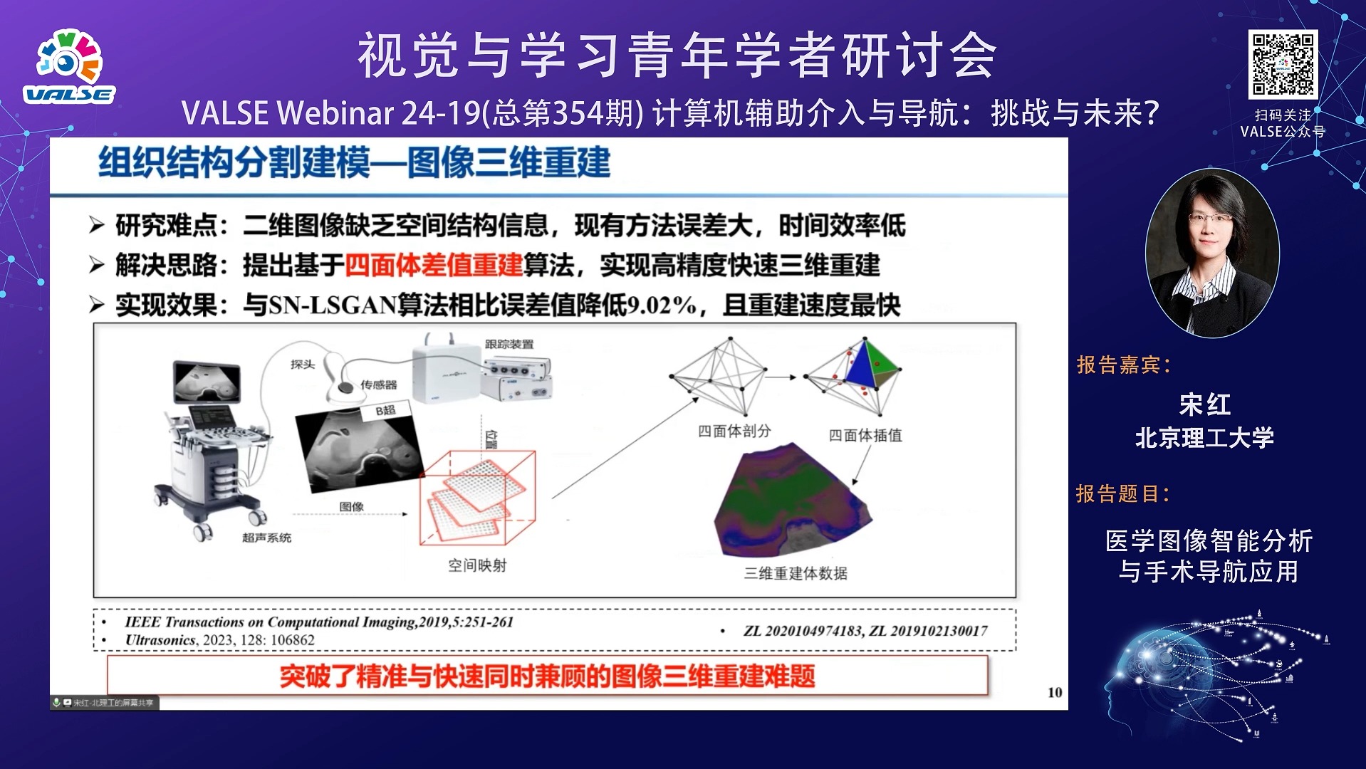 20240710【计算机辅助介入与导航:挑战与未来?】宋红:医学图像智能分析与手术导航应用哔哩哔哩bilibili