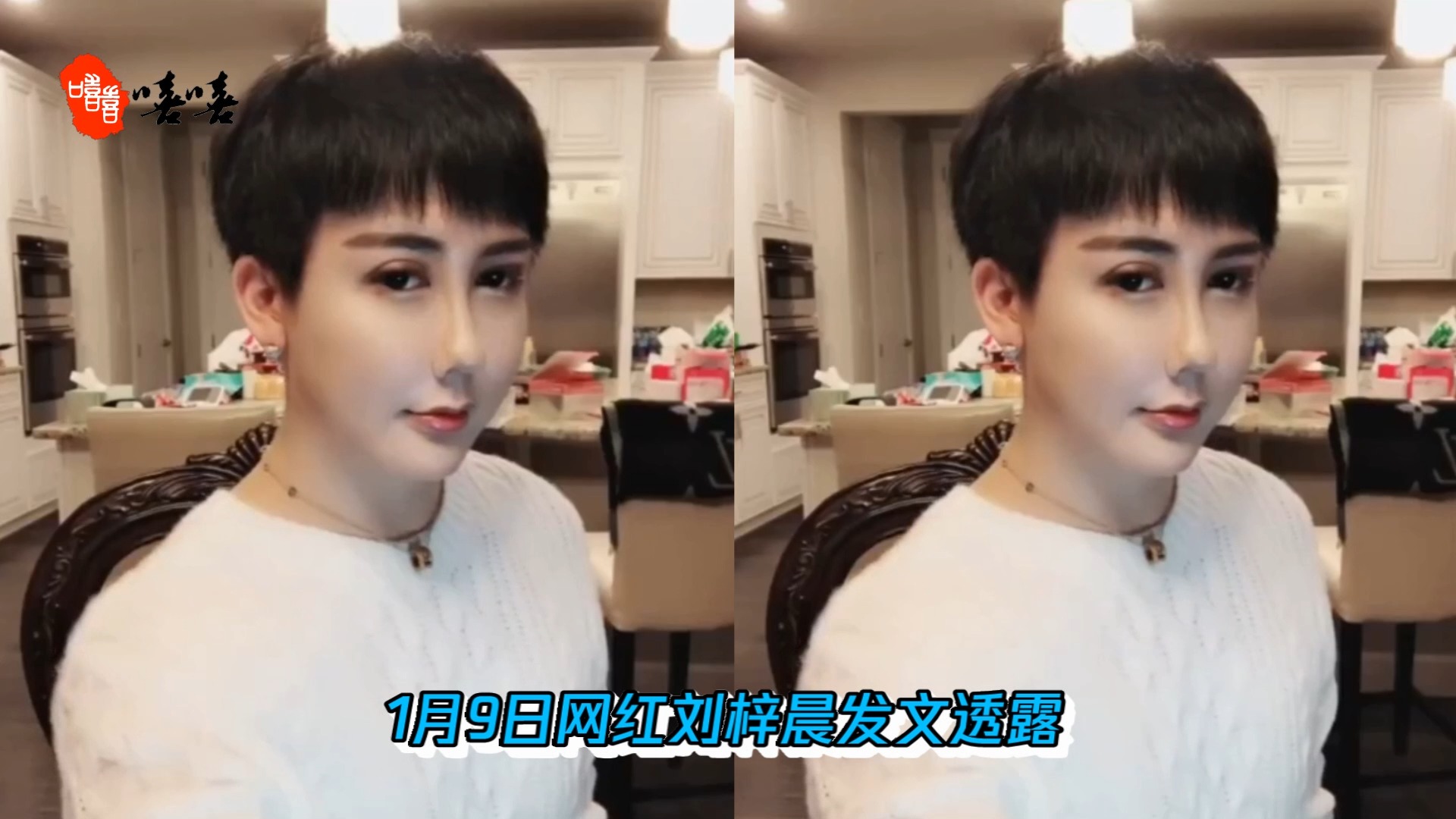 "蛇精男"刘梓晨确诊新冠病毒,曾谈整容跟生病了打针一样正常