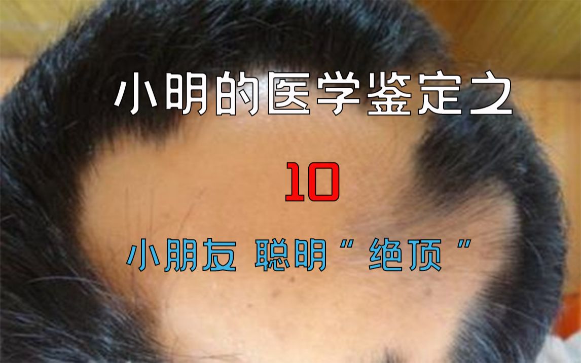 [图]【医学鉴定】网络热门医学视频鉴定10