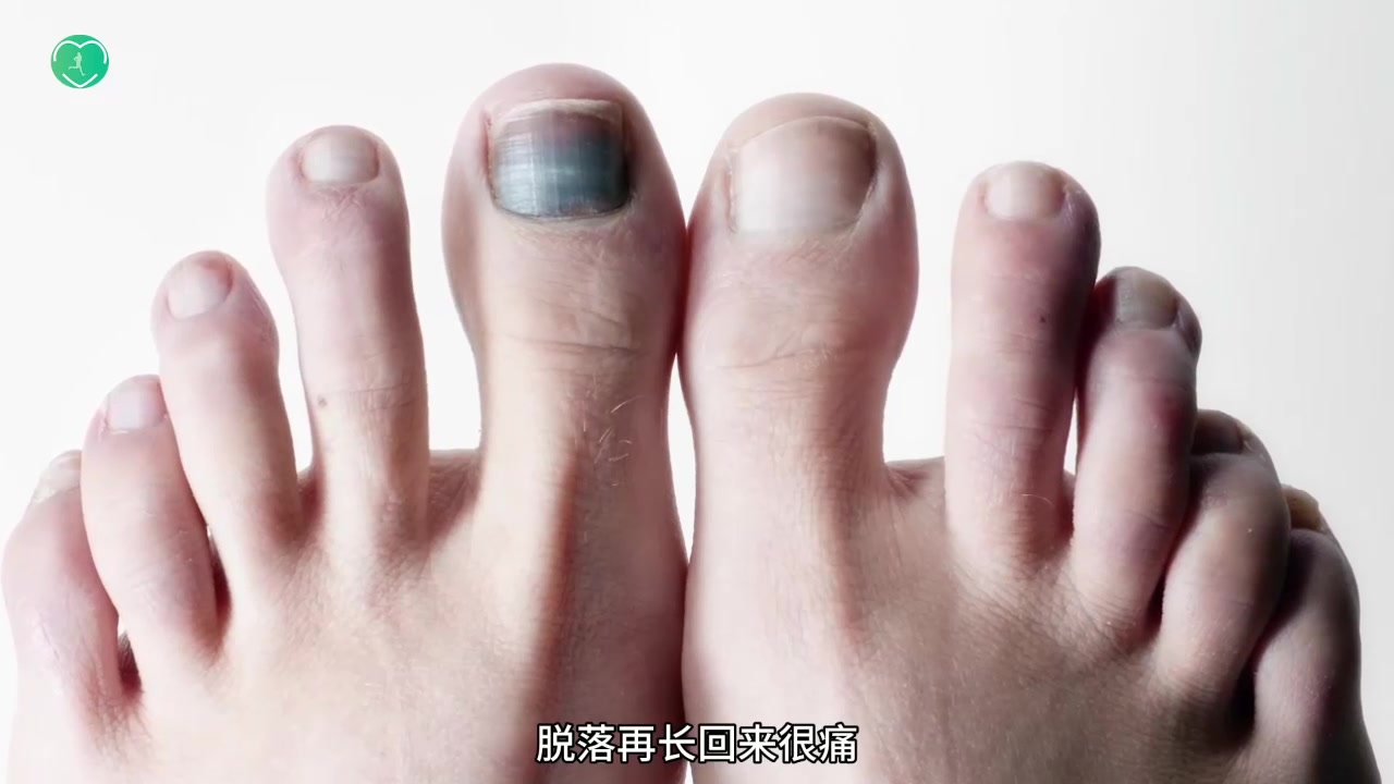 系鞋带的小方法 黑指甲