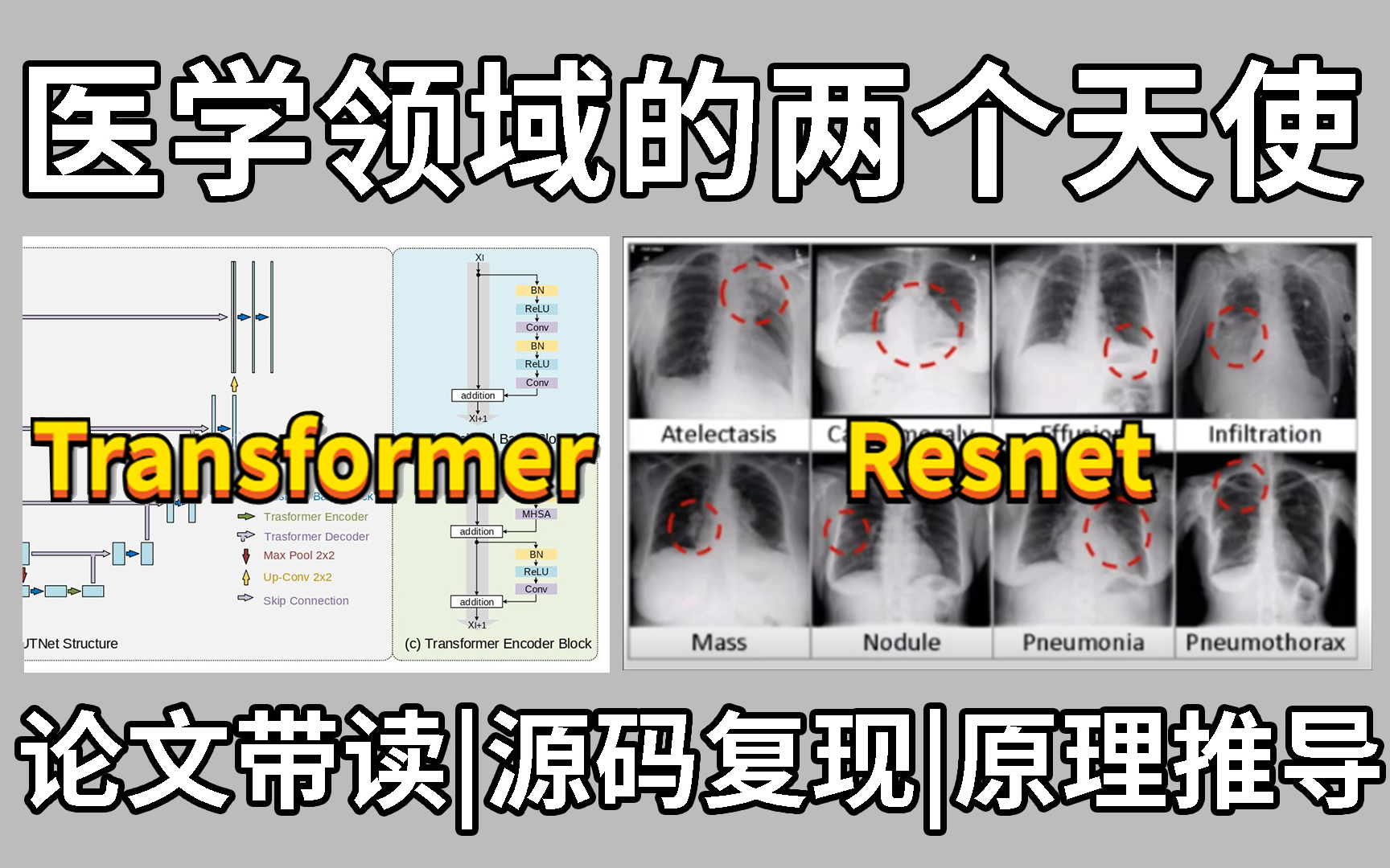 【Transformer+Resnet】医学分割图像实战教程:基于深度学习实现肿瘤图像分割实战,原理推导+代码复现!看完还跑不通你来打我!人工智能|医学分割应...