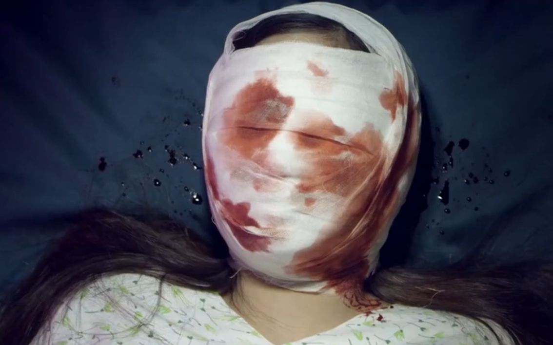 女孩为了变成美女跑去医院整容 结果手术失败变成这幅鬼模样!