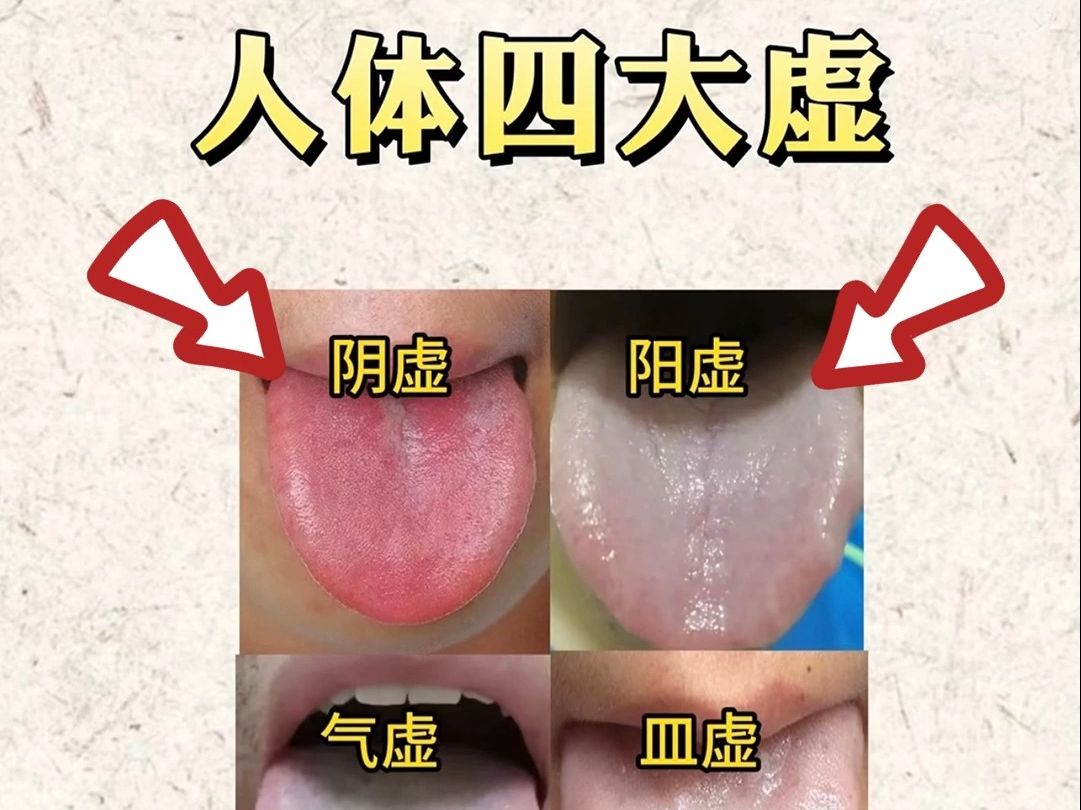 人体4大虚:阴虚、阳虚、气虚、血虚,看看你是哪种虚?哔哩哔哩bilibili