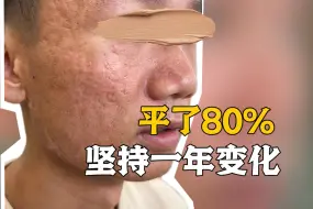 这种坑没想到还可以恢复到80%，真的惊艳到了