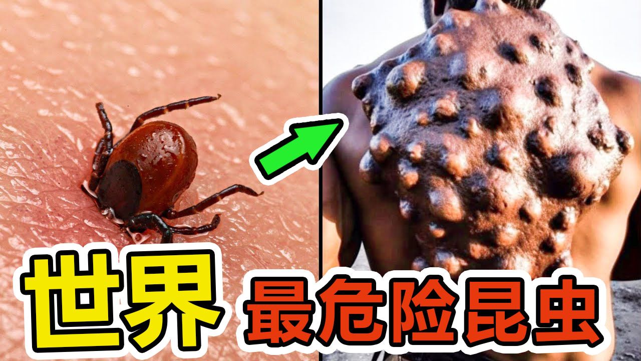 全世界最致命的10种昆虫,第一种见了赶紧远离,每年有上万人丧命