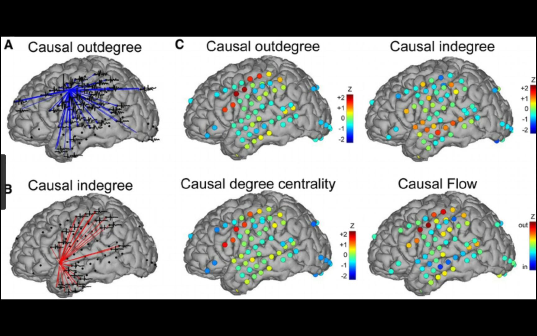 [图]The Brain Connectome Explained Through Graph Theory (Neurofeedback Implications)