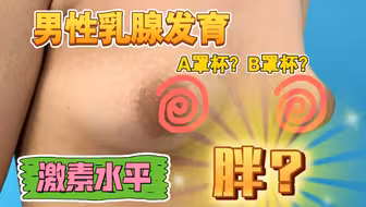 【男性乳腺发育】男性这种异常的乳腺发育，并非“胖”，多为激素失衡、药物或疾病引起，现在因为人们饮食习惯的问题，这种问题越来越多，微创吸脂就可矫正，恢复正常胸型