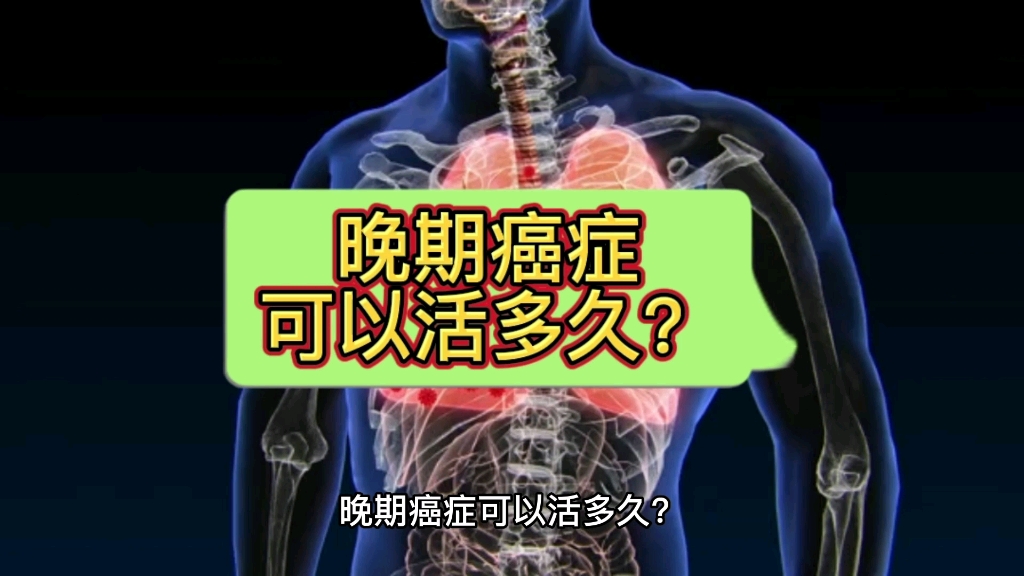 晚期癌症可以活多久?