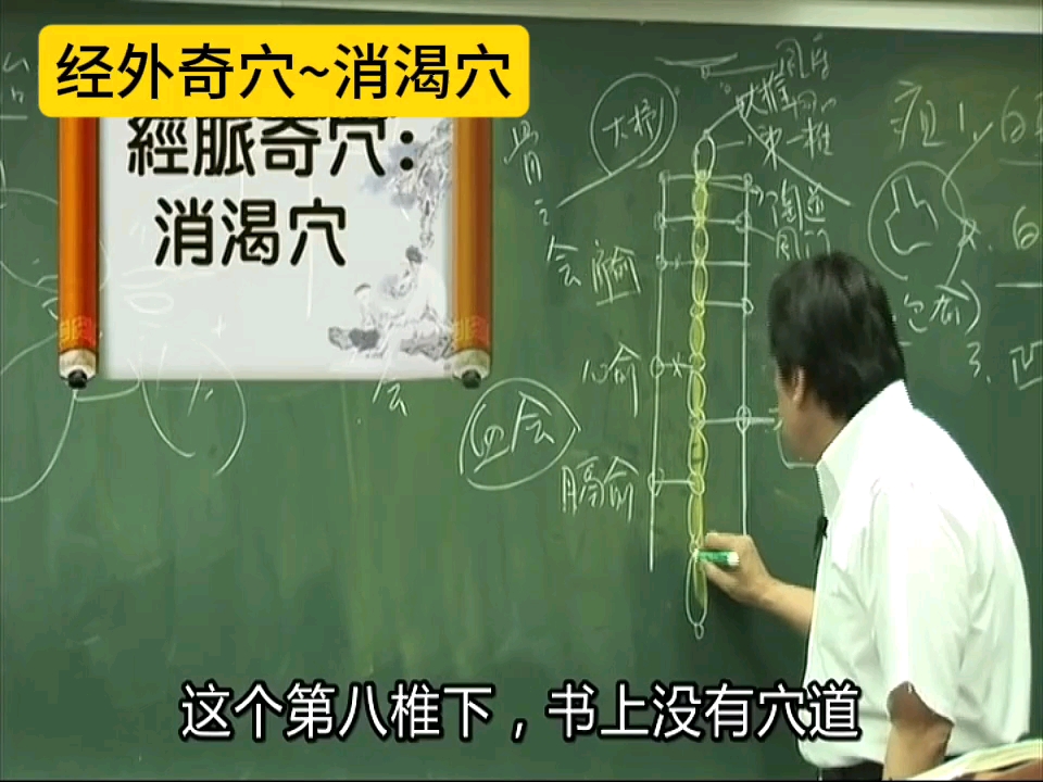 糖尿病,中医称为消渴病.上消,渴饮百碗不解渴.中消,饥饿不解.