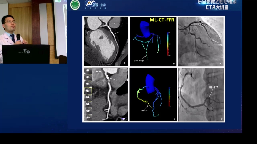 [图]01冠状动脉CTA综合诊断思路（全套课程见评论区）