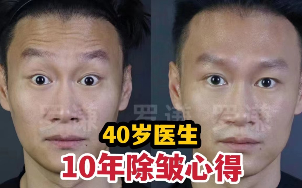 [图]40岁医生坚持给自己打了10年除皱之后…