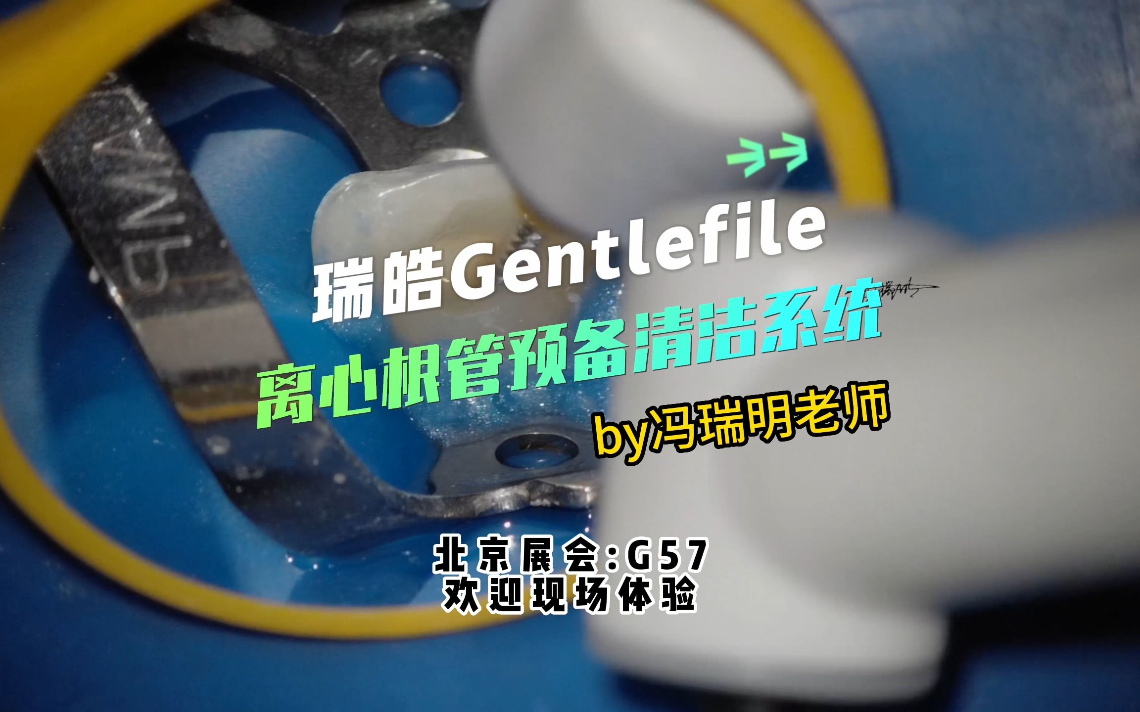 瑞皓Gentlefile离心根管预备清洁系统 北京展:G57哔哩哔哩bilibili