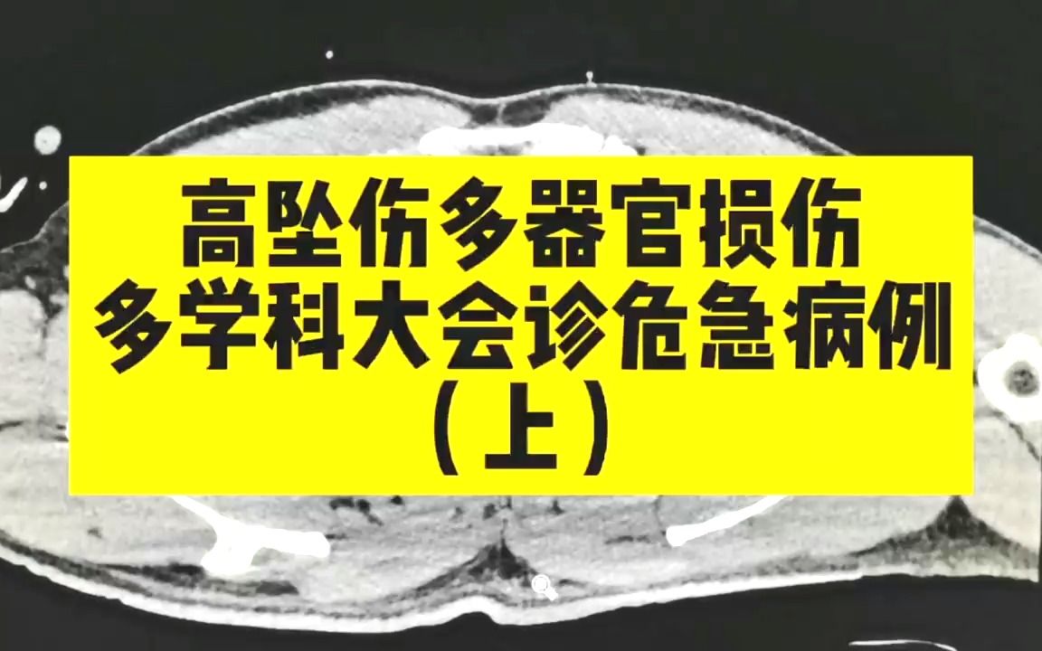 [图]30几岁年轻小伙，高8米坠落，全身多处器官损伤，夹层，脏器破裂