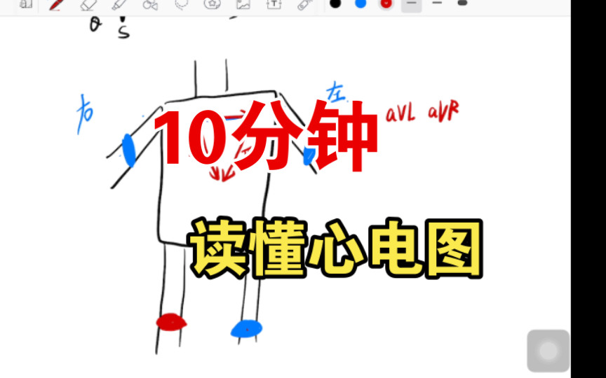 [图]十分钟读懂心电图！！！我怎么没早点知道这个知识！！
