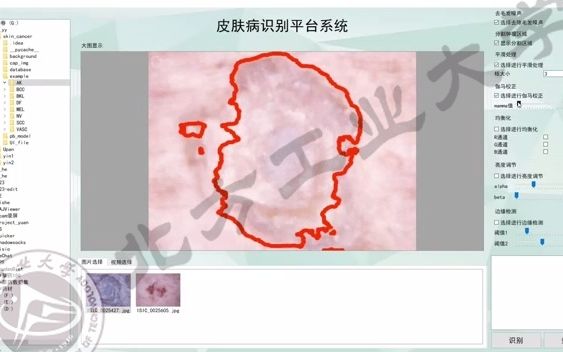 基于深度学习的皮肤病识别系统哔哩哔哩bilibili