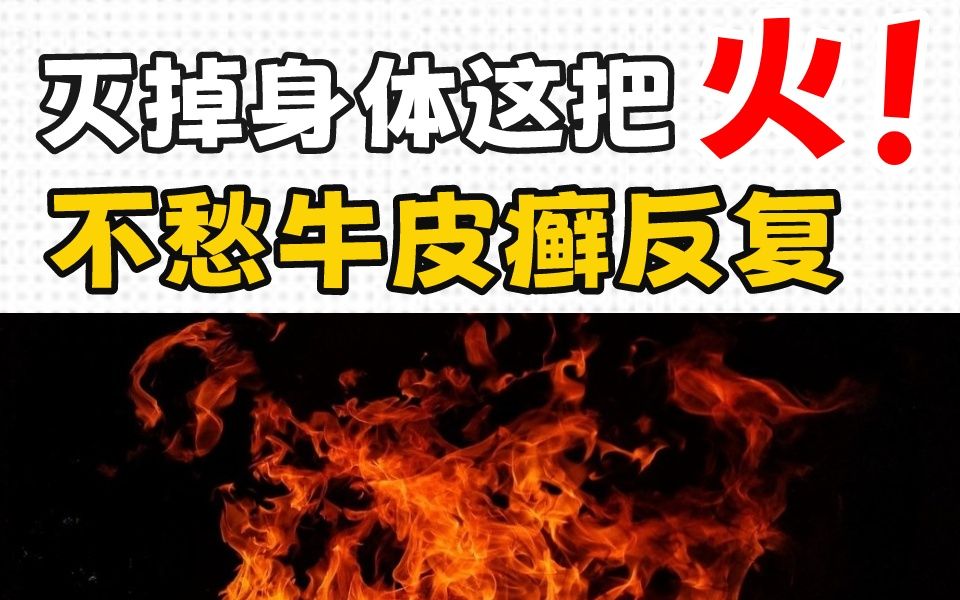 灭掉身体这把火,不愁牛皮癣不消退!哔哩哔哩bilibili