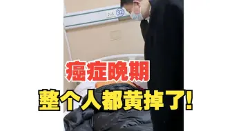 八旬老母肠癌肝转移，闺女哭成泪人，真的又心疼又无奈...