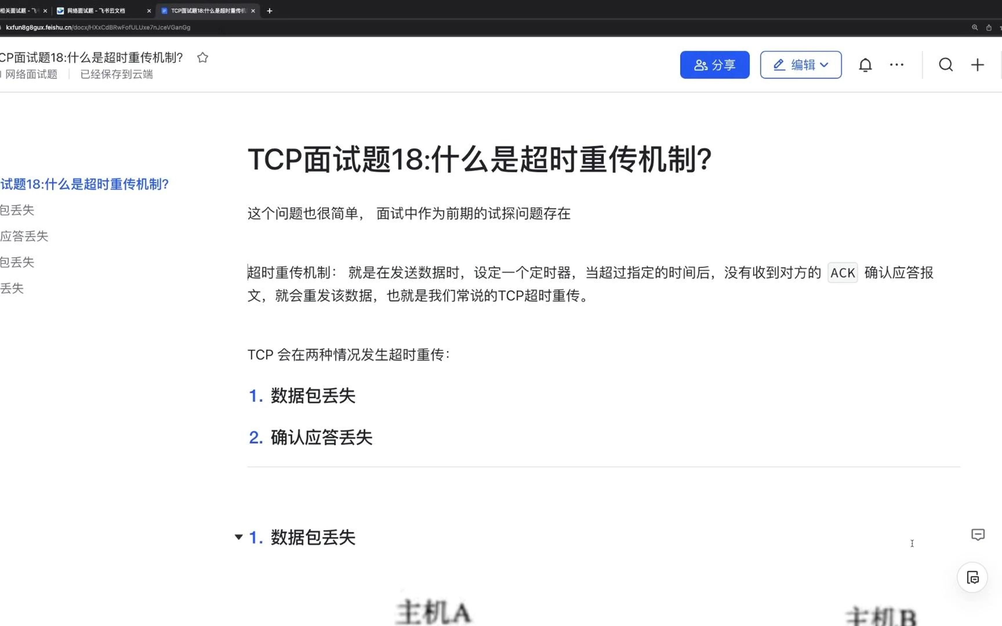 【B站最全TCP面试题】TCP面试题18:什么是超时重传机制?哔哩哔哩bilibili