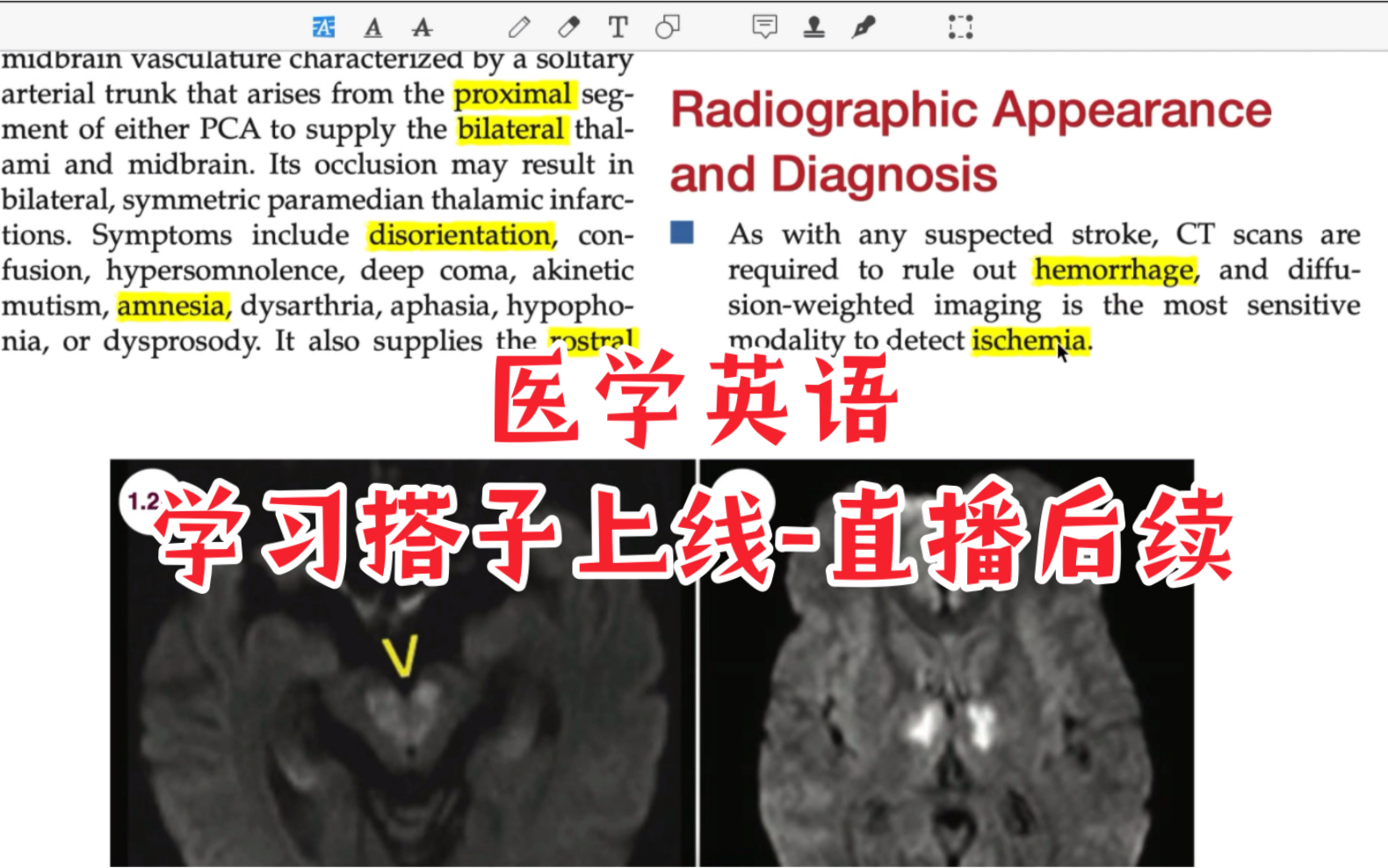 【医学英语】一些直播后续……学习搭子上线哔哩哔哩bilibili