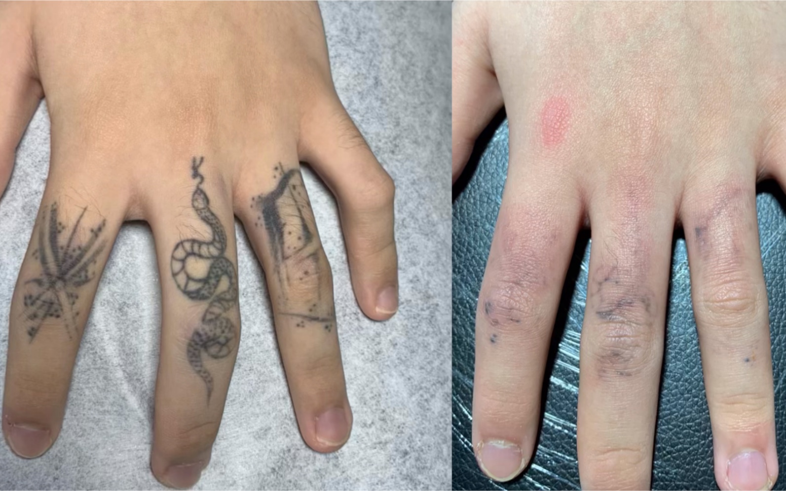 洗手指纹身第3次记录,要洗纹身的认真看看!