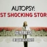 震撼解剖 autopsy most shocking stories