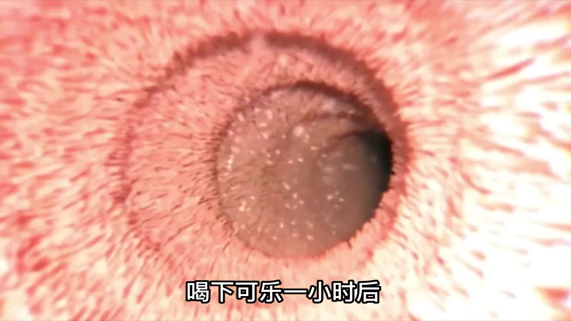 可乐危害有多大?哔哩哔哩bilibili