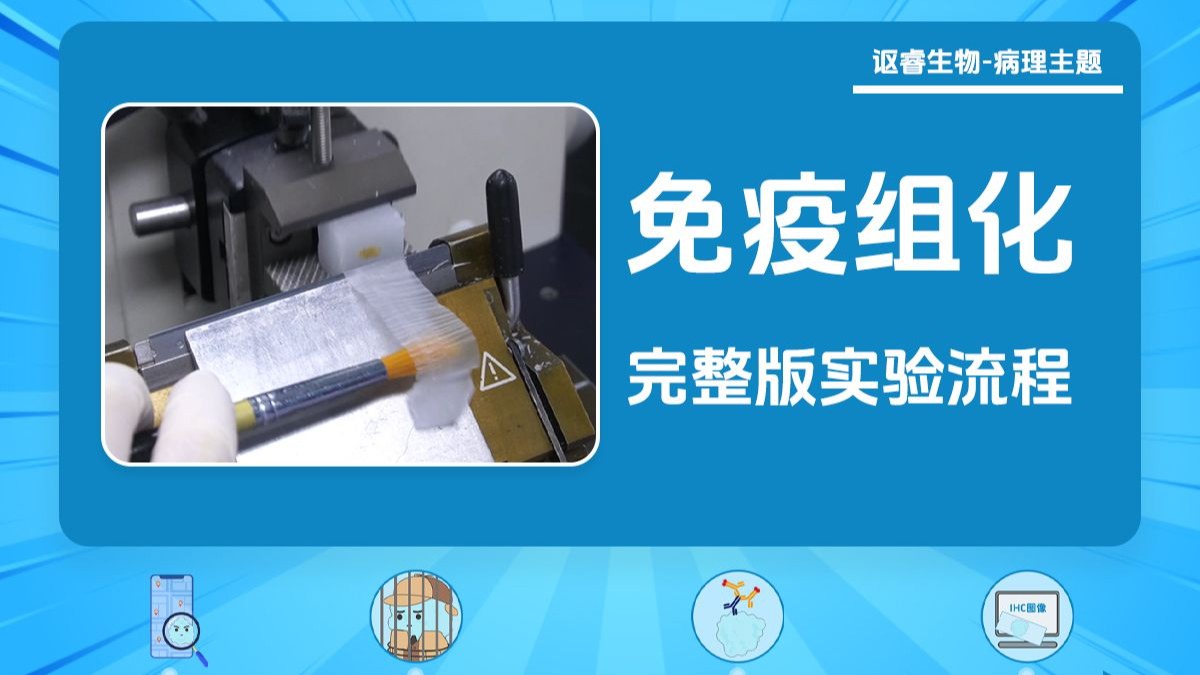 Complete IHC Protocol: Sampling to Mounting
