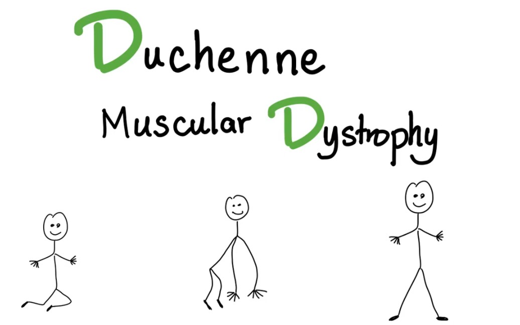 Duchenne Muscular Dystrophy哔哩哔哩bilibili