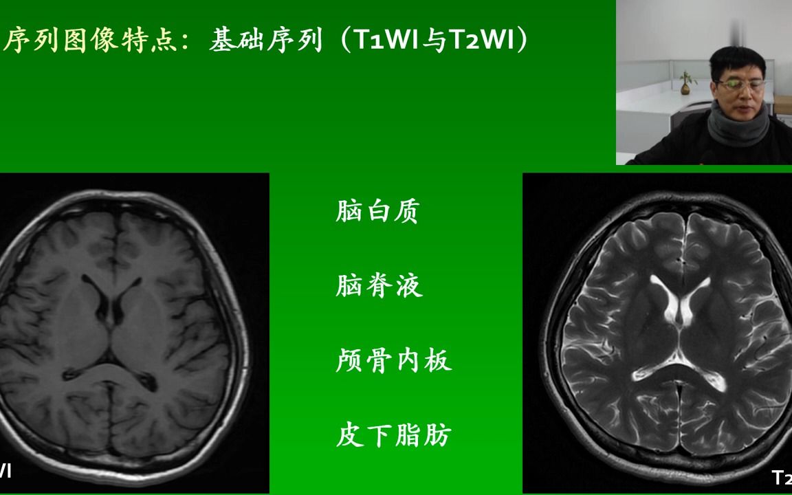 [3.2.1] 磁共振基础序列T1WI和T2WI哔哩哔哩bilibili