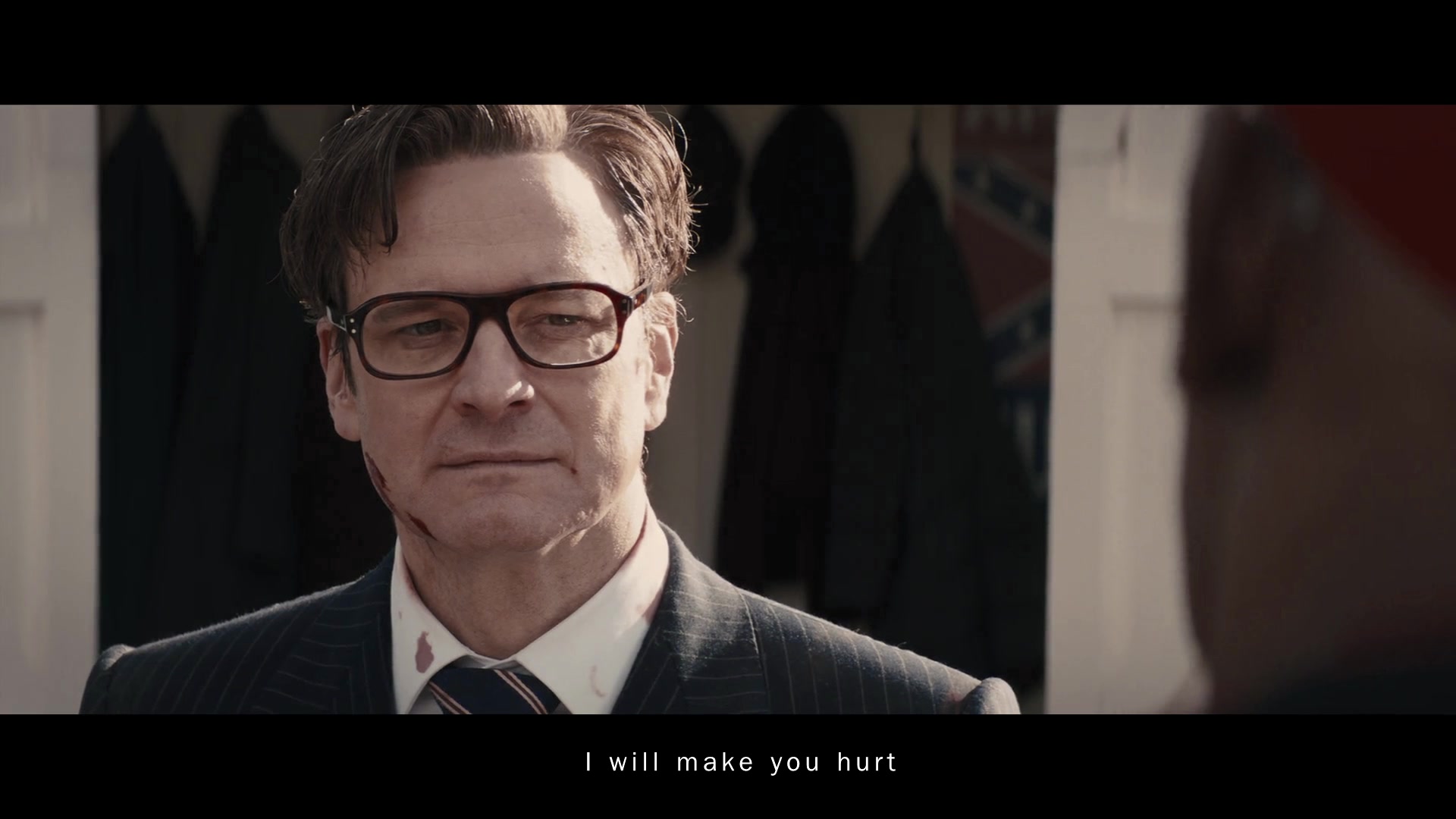 【kingsman/hartwin】hurt