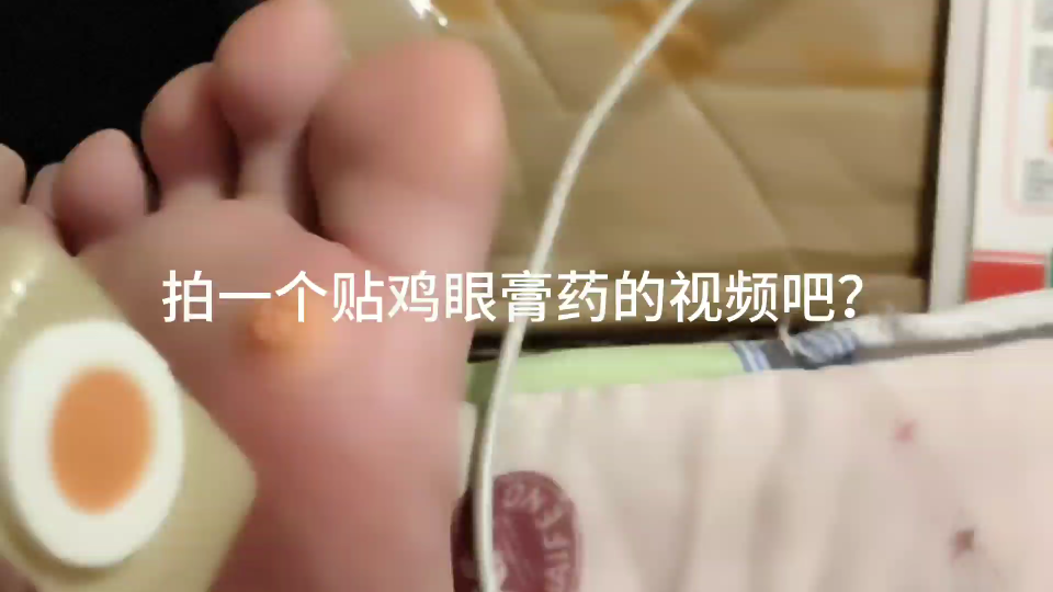 教你怎么贴鸡眼膏?哔哩哔哩bilibili