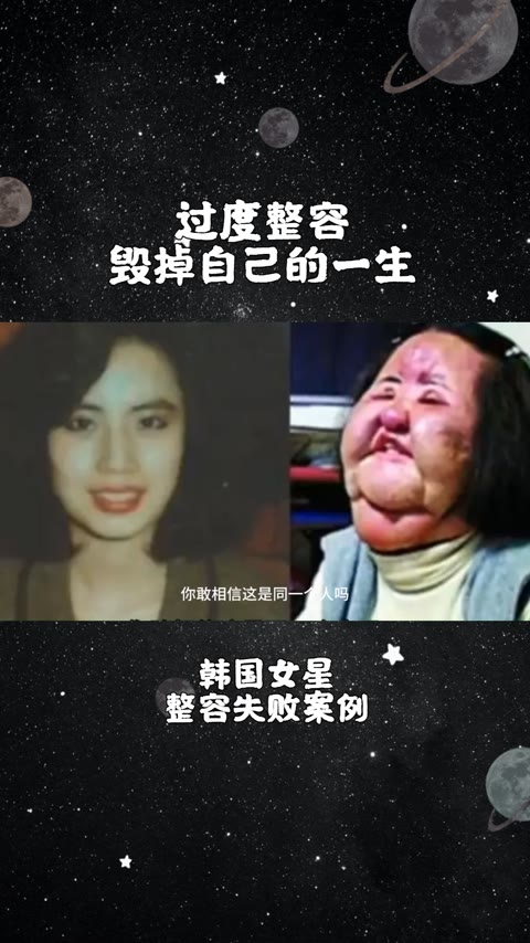 男整容女 全身图片