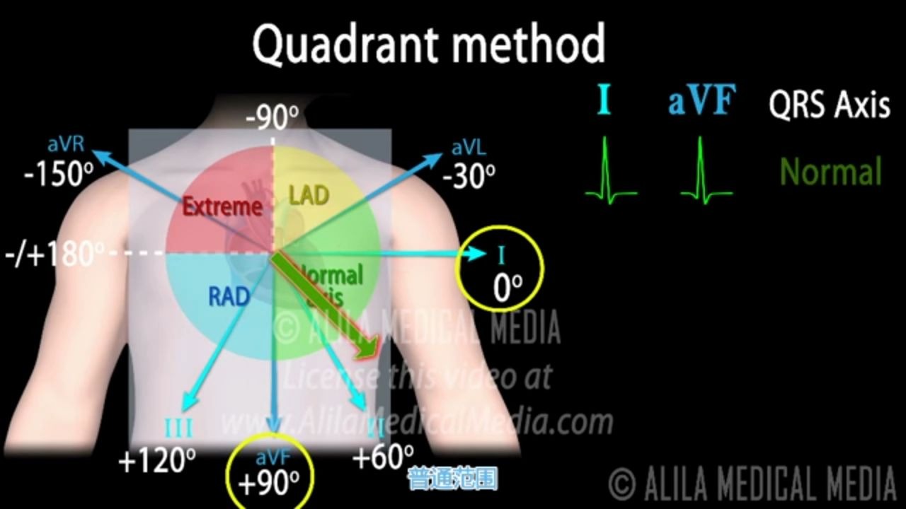 医学动画:什么是心电轴哔哩哔哩bilibili