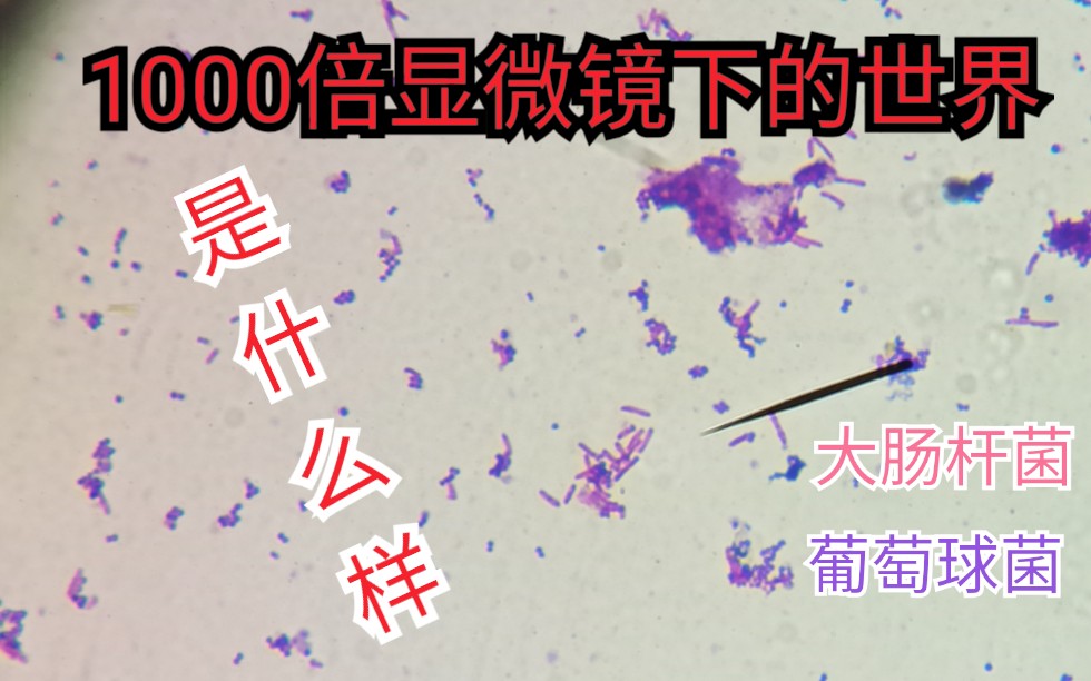 微生物学,大肠杆菌和葡萄球菌的革兰染色哔哩哔哩bilibili