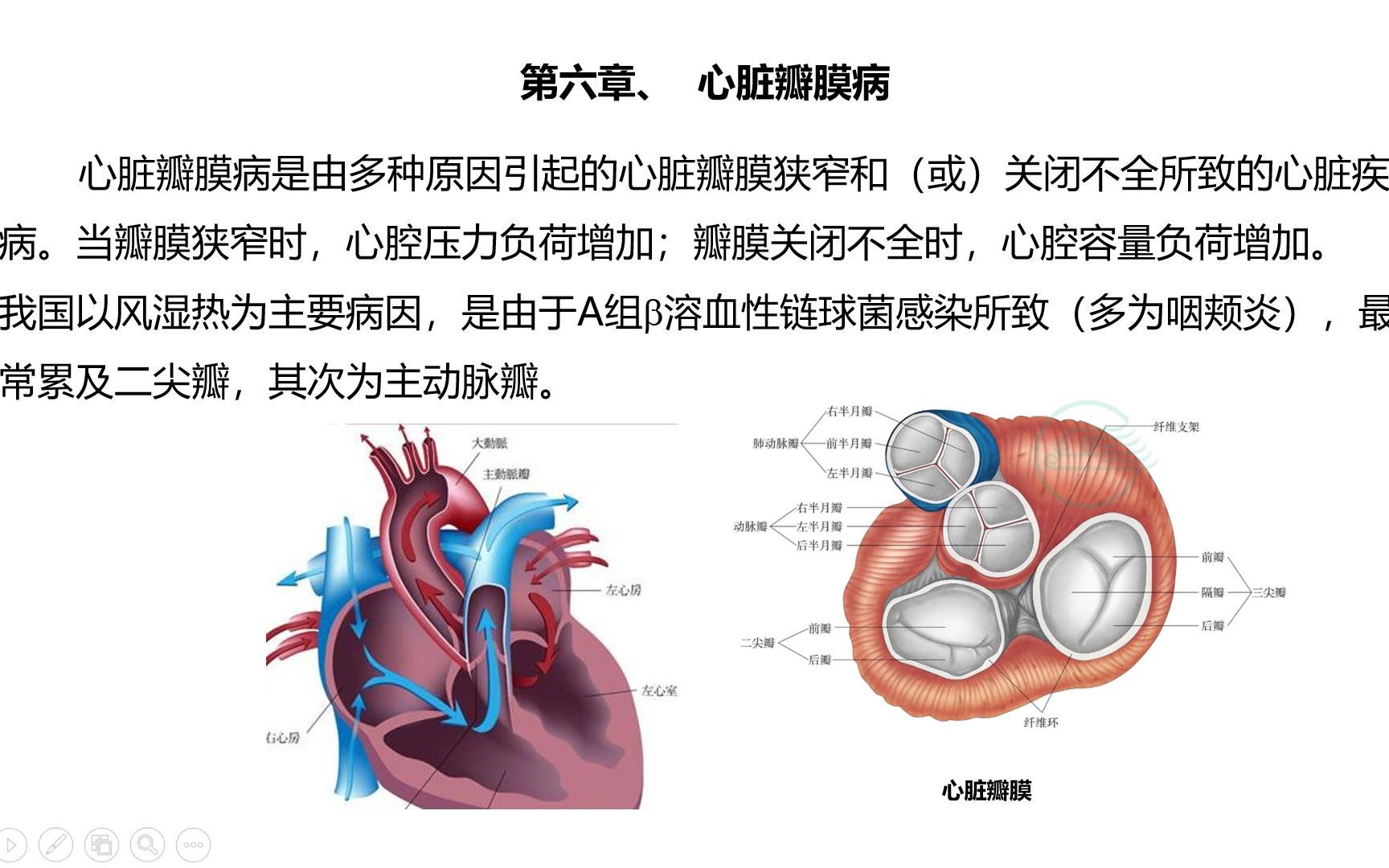 4、心脏瓣膜病1二尖瓣疾病哔哩哔哩bilibili