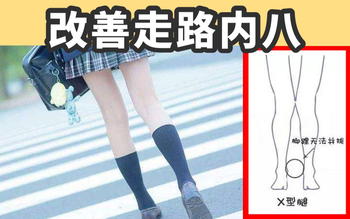 活动作品改善走路内八脚矫正走姿居家训练