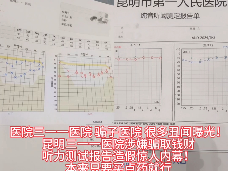 造假昆明三一一医院涉嫌骗取钱财,听力测试报告造假惊人内幕!哔哩哔哩bilibili