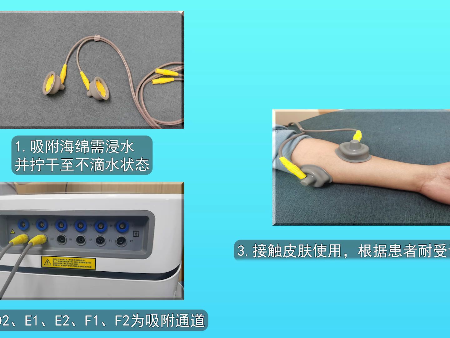 经皮神经电刺激-c——翔宇医疗