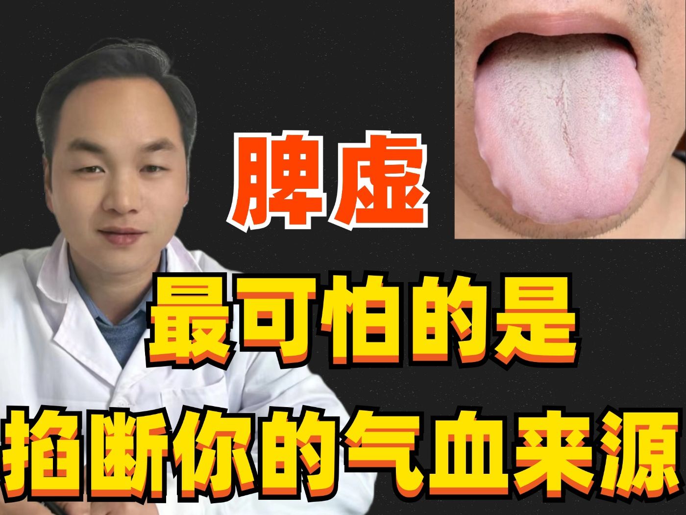 为什么脾虚的人,都容易气血亏?舌头胖大有齿痕,提示"气血枯竭"!