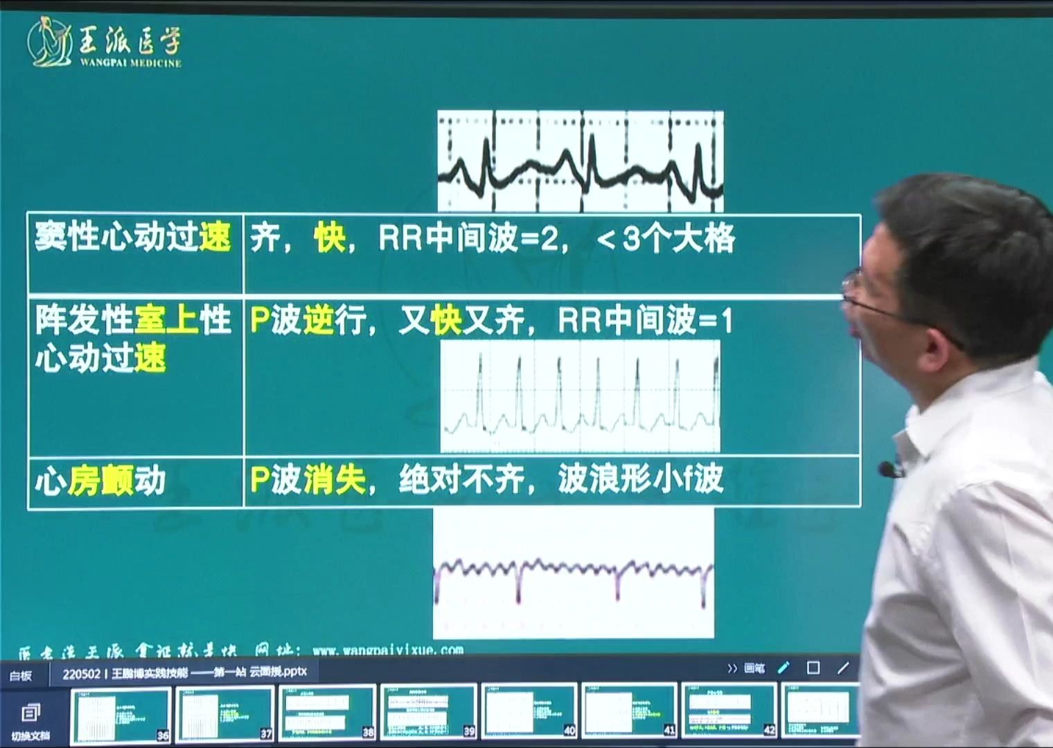 王博心电图医考必考点专讲窦性心动过速、室上速、房颤的区别哔哩哔哩bilibili